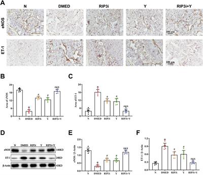 Inhibition of the RIP3/MLKL/TRPM7 necroptotic pathway ameliorates diabetes mellitus-induced erectile dysfunction by reducing cell death, fibrosis, and inflammation